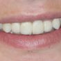 Dental Care Smile After Intervention