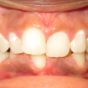 Treatment Dental Care Smile