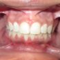 Dental Care Treatment Smile