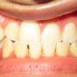 Dental Care Services Smile